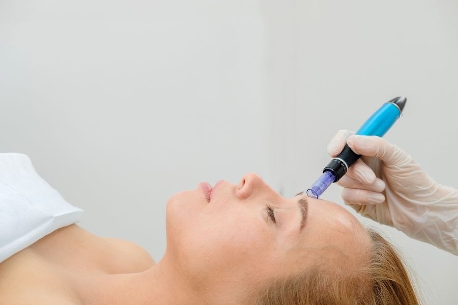 Gesichtsbehandlung Mesotherapie